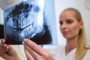Kiedy dentysta może zalecić wykonanie zdjęcia RTG zębów?